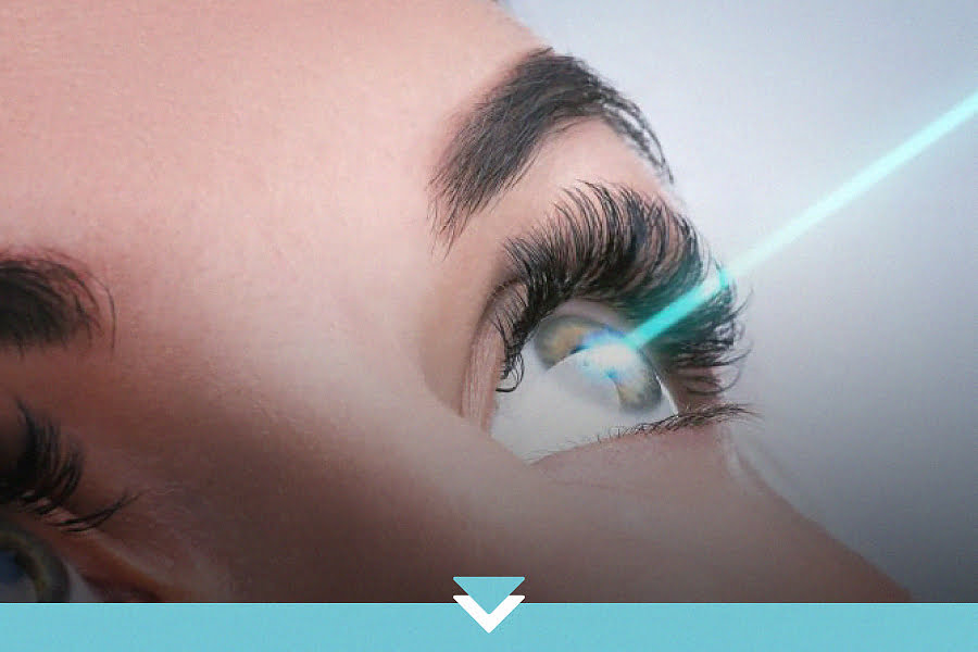 Cirurgia Refrativa a laser: quais são os diferenciais do procedimento?